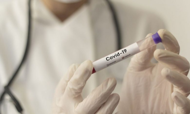 Dieron positivo de coronavirus los 12 vecinos de Catriló que fueron aislados