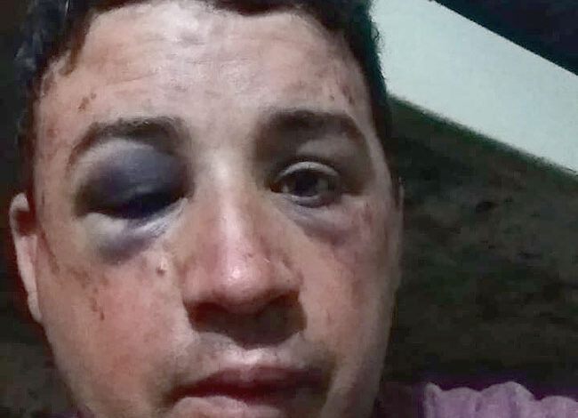 La Pampa-Denuncia feroz golpiza policial