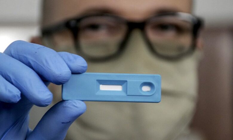 El test argentino que detecta Covid-19 en 5 minutos fue aprobado por ANMAT